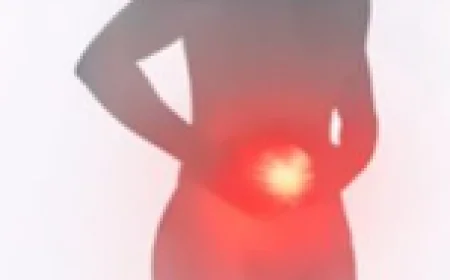 What Is a Hernia? Understanding Causes, Symptoms, and Treatment Options