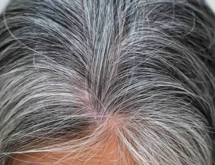 Why Am I Getting Grey Hair in My 20s? Experts Explain the Real Causes of Premature Greying