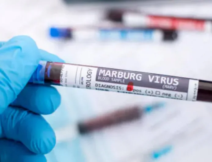 WHO Confirms Marburg Virus Case in Ugandan Toddler Amid Enhanced Ebola Surveillance