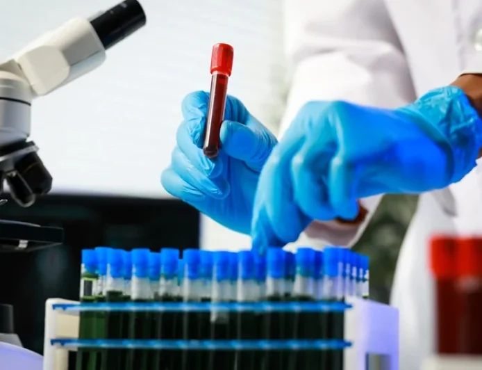 Serum REG3α Shows Promise for Detecting Ulcerative Colitis Disease Activity