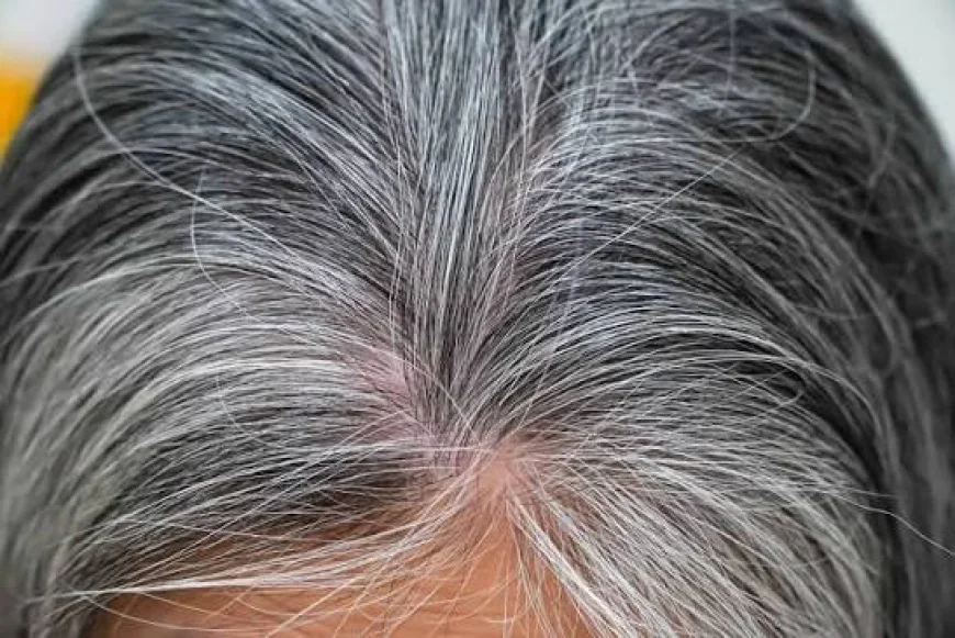 Why Am I Getting Grey Hair in My 20s? Experts Explain the Real Causes of Premature Greying