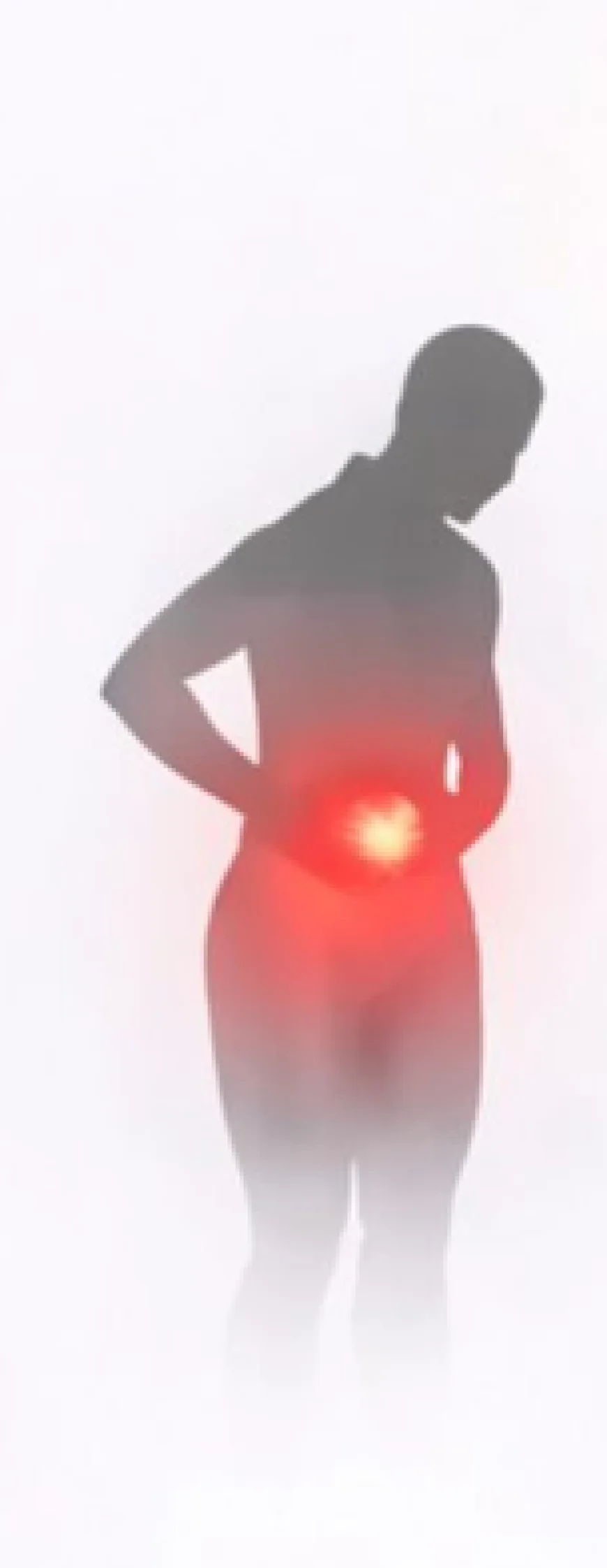 What Is a Hernia? Understanding Causes, Symptoms, and Treatment Options