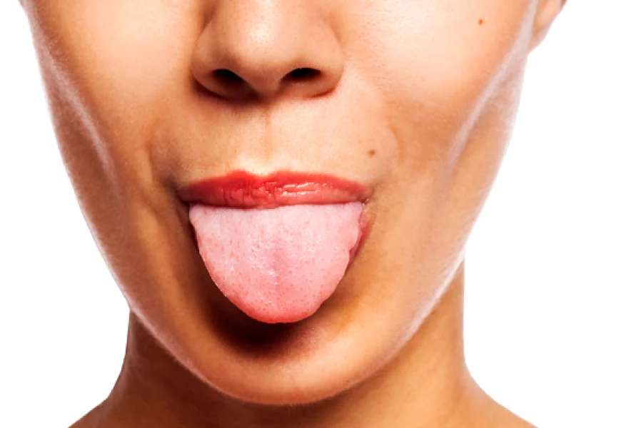 What Your Tongue Can Reveal About Your Health: Warning Signs You Shouldn't Ignore