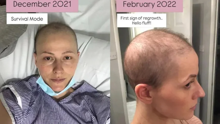 This Is What My Hair Looks Like Now': Breast Cancer Survivor Shares Honest Post-Chemotherapy Journey