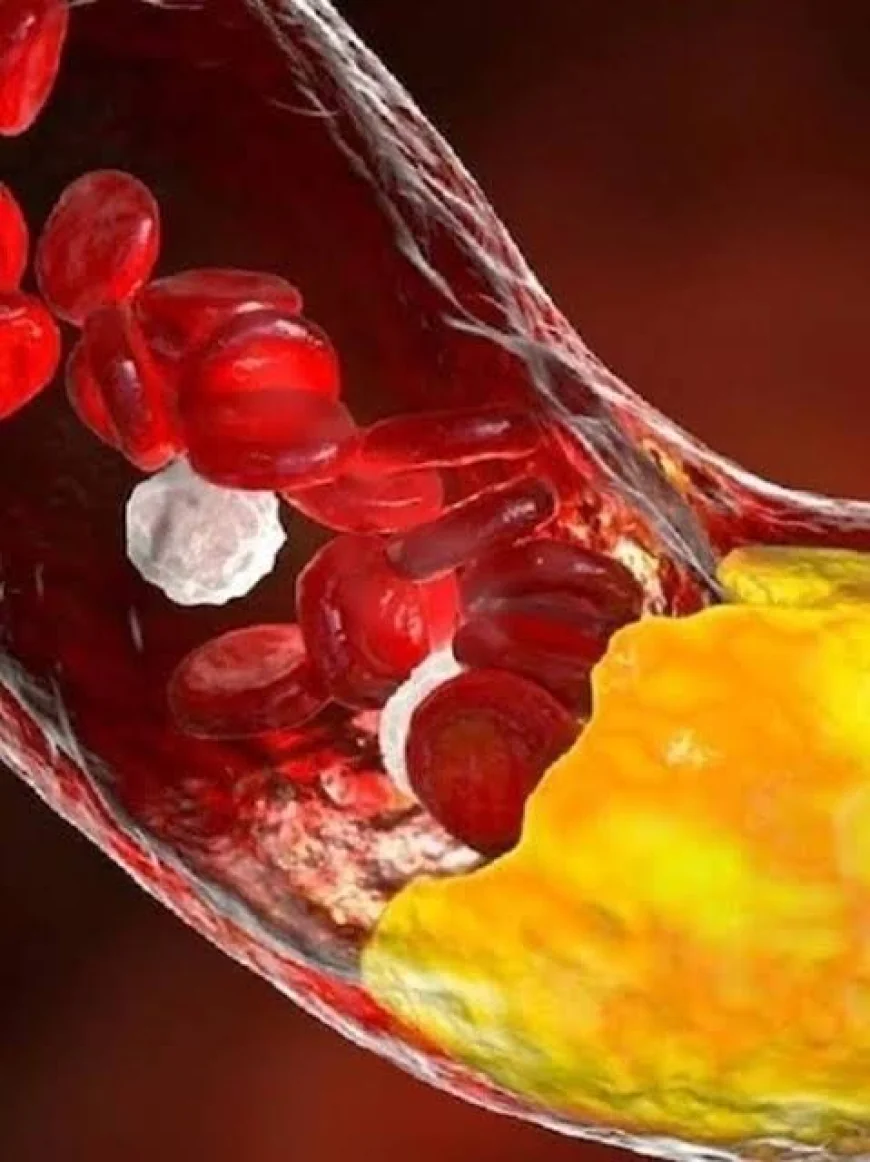 Low HDL Drives India’s Dyslipidemia Burden, ICMR–MDRF Study Finds